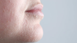 visage peaux hypersensibles et rougeurs hodygé