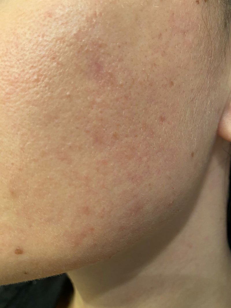 Femme 27 ans - After