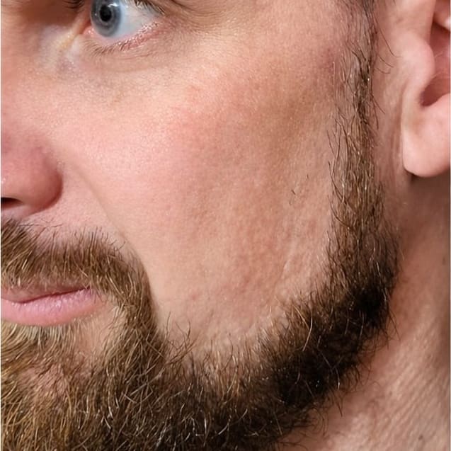 Homme 39 ans - After