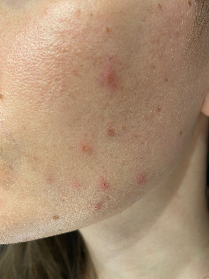 Femme 27 ans - Before