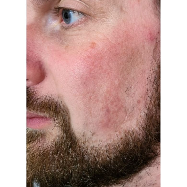 Homme 39 ans - Before